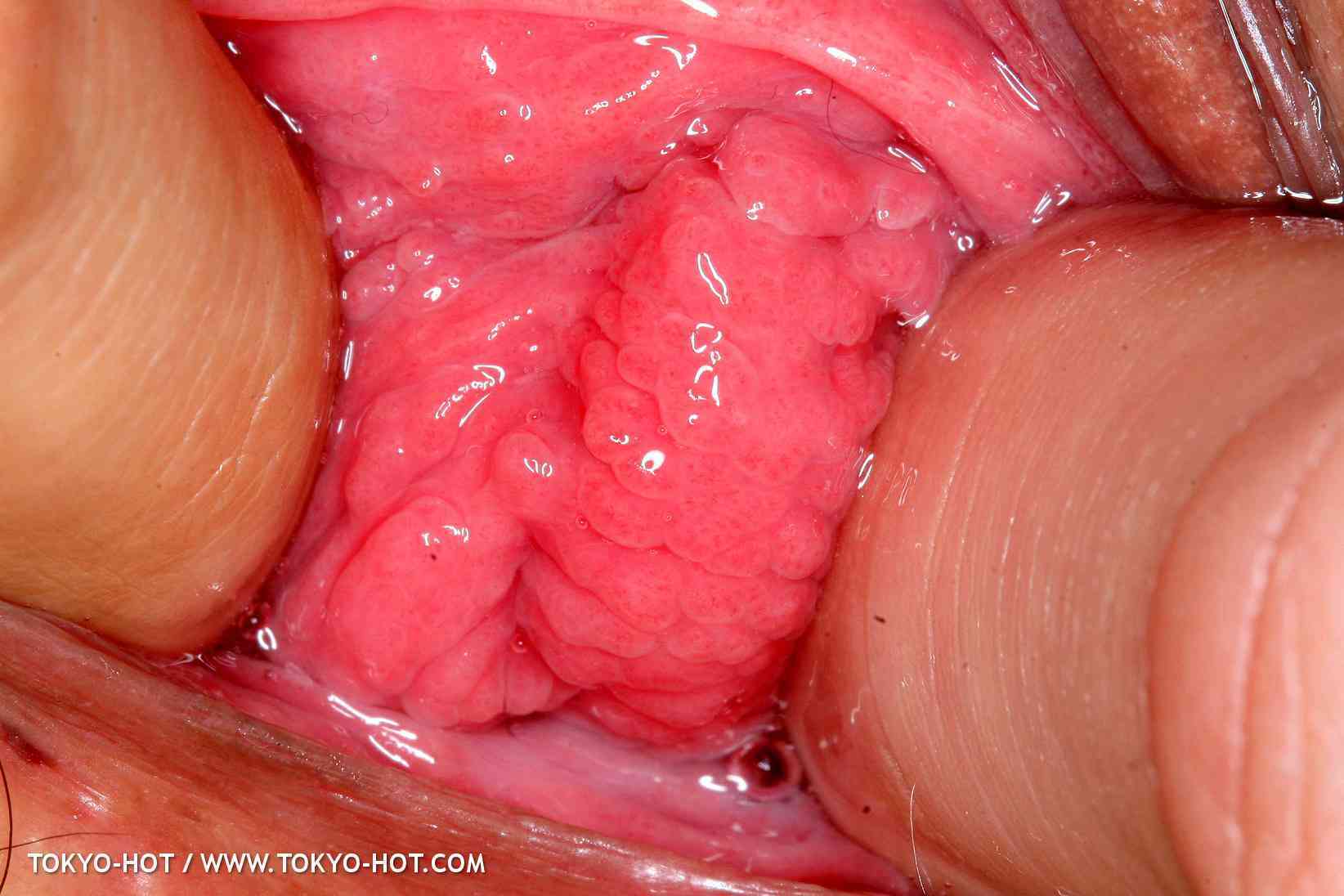 Ảnh nude japan full không che